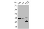Western Blot analysis of K562 PC-3 mouse liver cells using Cdc34 Polyclonal Antibody