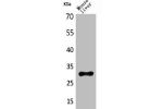 Western Blot analysis of mouse liver cells using FGF-5 Polyclonal Antibody