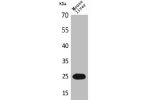 Western Blot analysis of mouse liver cells using CRP Polyclonal Antibody