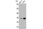 Western Blot analysis of MCF7 K562 cells using Cdk4 Polyclonal Antibody