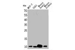 Western Blot analysis of MCF7 U251 mouse liver mouse kidney cells using ACBP Polyclonal Antibody