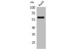 Western Blot analysis of HepG2 cells using ASIC3 Polyclonal Antibody