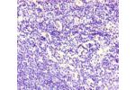 Immunohistochemistry of paraffin-embedded human lymphoid tissue using CSB-PA005124LA01HU at dilution of 1:100