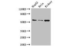 Western Blot<br />
Positive WB detected in:HepG2 whole cell lysate,Hela whole cell lysate,Mouse kidney tissue<br />
All lanes:CDT1 antibody at 3