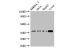 Western Blot<br />
Positive WB detected in:RAW264.7 whole cell lysate,Hela whole cell lysate,HepG2 whole cell lysate,Mouse liver tissue<br />
All lanes:CDX4 antibody at 3