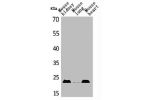 Western Blot analysis of mouse kidney mouse lung mouse heart cells using ADM Polyclonal Antibody