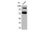 Western Blot analysis of HepG2 cells using CEACAM1/5 Polyclonal Antibody