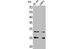 Western Blot analysis of HL-60 22RV-1 cells using MIP-1