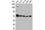 Western Blot analysis of A549 HuvEc HT29 K562 L929 cells using Fascin 1 Polyclonal Antibody