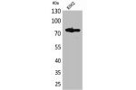 Western Blot analysis of K562 cells using FOXP1 Polyclonal Antibody