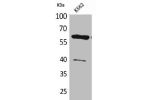 Western Blot analysis of K562 cells using CYP11A1 Polyclonal Antibody
