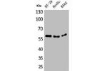 Western Blot analysis of HT29 HuvEc K562 cells using CYP11B1/2 Polyclonal Antibody