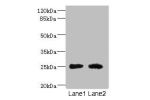 Western blot<br />
All lanes: CEACAM4 antibody at 1.81ug/ml<br />
Lane 1 : Rat heart tissue<br />
Lane 2 : Mouse brain tissue<br />
Secondary<br />
Goat polyclonal to rabbit IgG at 1/10000 dilution<br />
Predicted band size: 26 kDa<br />
Observed band siz