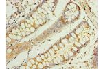 Immunohistochemistry of paraffin-embedded human rectum using CSB-PA005168ESR2HU at dilution 1:100