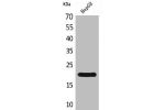 Western Blot analysis of HepG2 cells using VHR Polyclonal Antibody