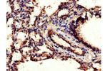 Immunohistochemistry of paraffin-embedded human lung tissue using CSB-PA005181LA01HU at dilution of 1:100