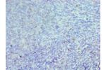 Immunohistochemistry of paraffin-embedded human tonsil using CSB-PA005184DSR1HU at dilution 1:100