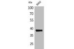 Western Blot analysis of K562 cells using CD1C Polyclonal Antibody
