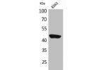 Western Blot analysis of K562 cells using CD1E Polyclonal Antibody