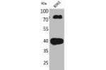 Western Blot analysis of K562 cells using CD2 Polyclonal Antibody