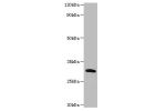 Western blot<br />
All lanes: Chymotrypsin-like elastase family member 2A antibody at 2ug/ml+recombinant Chymotrypsin-like elastase family member 2A protein 0.1ug<br />
Secondary<br />
Goat polyclonal to Rabbit lgG at 1/15000 dilution<br />
Predicted band