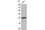 Western Blot analysis of K562 cells using CD7 Polyclonal Antibody