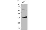 Western Blot analysis of K562 cells using CD28 Polyclonal Antibody