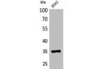 Western Blot analysis of K562 cells using CD32-A Polyclonal Antibody