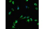 Immunofluorescent analysis of Hela cells using CSB-PA005205LA01HU at a dilution of 1:100 and Alexa Fluor 488-congugated AffiniPure Goat Anti-Rabbit IgG(H+L)