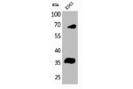 Western Blot analysis of K562 cells using CD32-B/C Polyclonal Antibody
