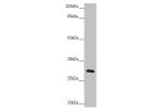 Western blot<br />
All lanes:CENPH antibody at 1.61 ug/ml+ Mouse lung tissue<br />
Secondary<br />
Goat polyclonal to rabbit IgG at 1/10000 dilution<br />
Predicted band size: 28 kDa<br />
Observed band size: 28 kDa<br />