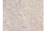 Immunohistochemistry of paraffin-embedded human tonsil tissue using CSB-PA005211ESR2HU at dilution of 1:100