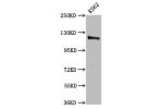 Western Blot<br />
Positive WB detected in:K562 whole cell lysate<br />
All lanes:CENPJ antibody at 3.2
