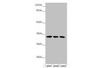 Western blot<br />
All lanes:CENPK antibody at 4.17 ug/ml<br />
Lane 1 : PC-3 whole cell lysate<br />
Lane 2 : 293T whole cell lysate<br />
Lane 3 : Hela whole cell lysate<br />
Secondary<br />
Goat polyclonal to rabbit IgG at 1/10000 dilution<br />
Predi