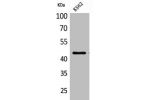 Western Blot analysis of K562 cells using CD48 Polyclonal Antibody