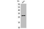 Western Blot analysis of K562 cells using CD58 Polyclonal Antibody