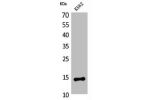 Western Blot analysis of K562 cells using CD59 Polyclonal Antibody