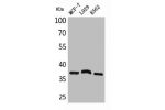 Western Blot analysis of MCF7 L929 K562 cells using CD79b Polyclonal Antibody