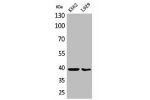 Western Blot analysis of K562 L929 cells using CD84 Polyclonal Antibody