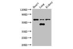 Western Blot<br />
Positive WB detected in:Mouse heart tissue,Mouse lung tissue,Mouse kidney tissue<br />
All lanes:CERK antibody at 3