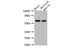 Western Blot<br />
Positive WB detected in:Mouse heart tissue,Mouse skeletal muscle tissue<br />
All lanes:CES1 antibody at 5ug/ml<br />
Secondary<br />
Goat polyclonal to rabbit IgG at 1/50000 dilution<br />
Predicted band size: 63 kDa<br />
Observed ban