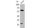 Western Blot analysis of HepG2 cells using GGT1 Polyclonal Antibody