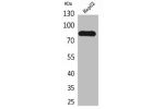 Western Blot analysis of HepG2 cells using CD248 Polyclonal Antibody