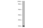 Western blot<br />
All lanes:CETN3 antibody at 1.77 ug/ml+ Mouse gonadal tissue<br />
Secondary<br />
Goat polyclonal to rabbit IgG at 1/10000 dilution<br />
Predicted band size: 20 kDa<br />
Observed band size: 20 kDa<br />
