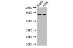 Western Blot<br />
Positive WB detected in:HepG2 whole cell lysate,A549 whole cell lysate<br />
All lanes:CFB antibody at 2.8