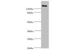 Western blot<br />
All lanes:CFH antibody at 3ug/ml+human serumSecondary<br />
Goat polyclonal to rabbit at 1/10000 dilution<br />
Predicted band size: 140,52 kDa<br />
Observed band size: 139 kDa<br />
