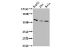 Western Blot<br />
Positive WB detected in:HepG2 whole cell lysate,293 whole cell lysate,Hela whole cell lysate<br />
All lanes:CFI antibody at 3.2