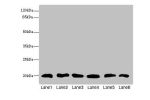 Western blot<br />
All lanes: CFL2 antibody at 3.75ug/ml<br />
Lane 1 : Mouse brain tissue<br />
Lane 2 : Mouse liver tissue<br />
Lane 3 : Mouse lung tissue<br />
Lane 4 : LO2 whole cell lysate<br />
Lane 5 : Hela whole cell lysate<br />
Lane 6 : A549 wh