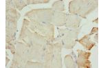 Immunohistochemistry of paraffin-embedded human skeletal muscle tissue using CSB-PA005281ESR2HU at dilution 1:100
