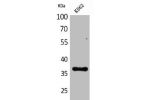 Western Blot analysis of K562 cells using CD207 Polyclonal Antibody